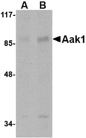 IHC-plus™ Polyclonal Rabbit anti-Human AAK1 Antibody (IHC, WB)