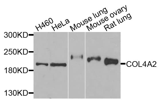 COL4A2 / Collagen IV Alpha2 Antibody