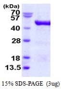 Human VAT1 Protein (Recombinant His)