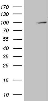 PYGM Antibody (aa698-842, clone OTI3F9, Carrier-free)