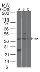IHC-plus™ HTRA3 Antibody (aa250-300)