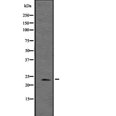 WFDC2 / HE4 Antibody