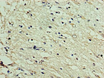 Polyclonal Rabbit anti-Human DNAJC30 Antibody (IHC)