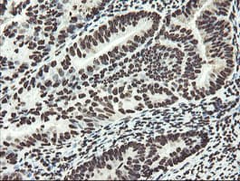 Monoclonal Mouse anti-Human NONO / P54NRB Antibody (clone OTI2E7, IHC, WB)