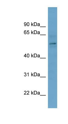 CBX2 Antibody (C-Terminus)
