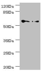 CCT5 / TCP1 Epsilon Antibody
