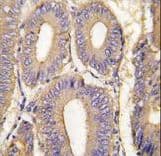 Polyclonal Rabbit anti-Human PAK1 Antibody (Thr423, IHC, IF, WB)