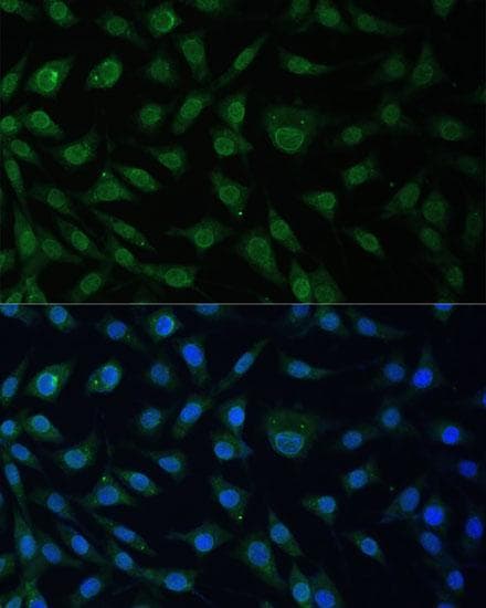 NUP214 / CAN Antibody