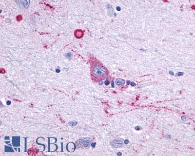 PathPlus™ Polyclonal Rabbit anti-Human HTR7 / 5HT7 Receptor Antibody (C-Terminus, IHC)