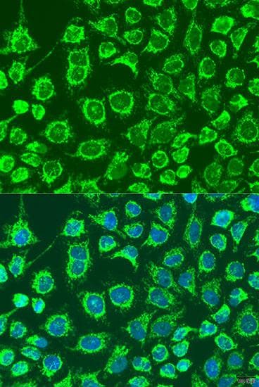 GYPB / CD235b / Glycophorin B Antibody