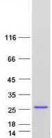 Human HRAS / H-Ras Protein (Recombinant Myc-DDK (Flag))
