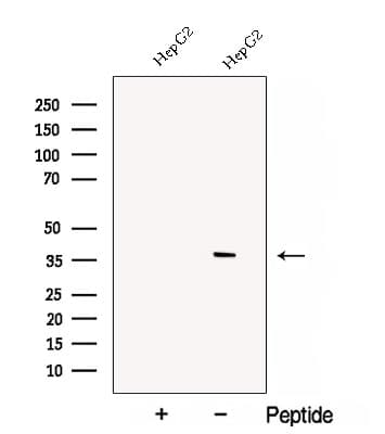 C1GALT1C1 Antibody