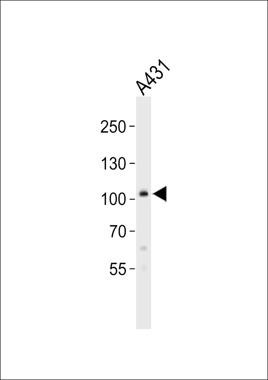 Polyclonal Rabbit anti-Human COL6A1 / Collagen VI Alpha 1 Antibody (aa831-858, IHC, IF, WB)