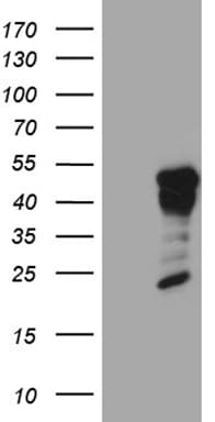 GCM1 Antibody (clone OTI4E2, Carrier-free)
