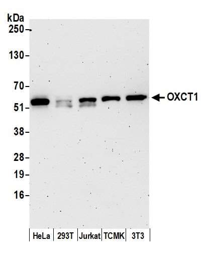 OXCT1 Antibody (aa25-75)