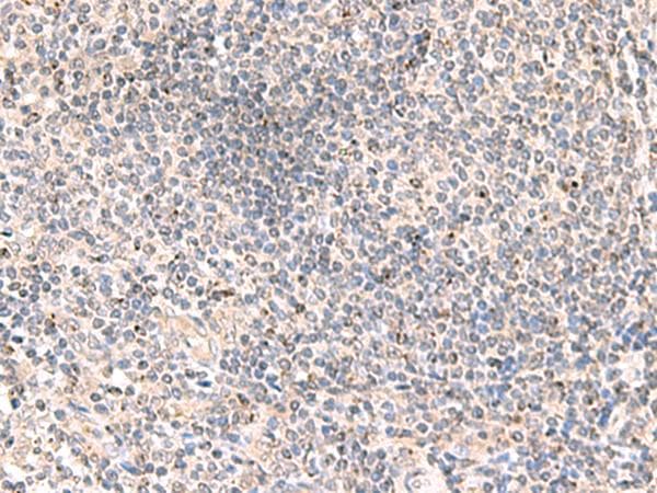 Polyclonal Rabbit anti-Human MLKL Antibody (IHC)