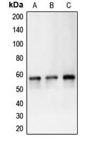 IHC-plus™ Polyclonal Rabbit anti-Human CA9 / Carbonic Anhydrase IX Antibody (Internal, IHC, WB)