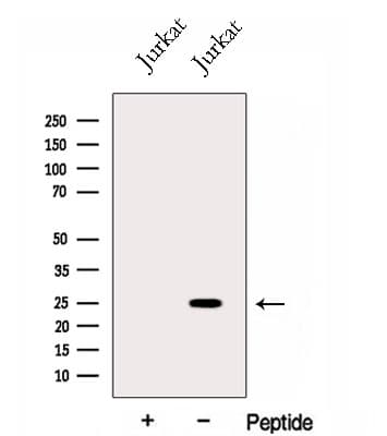 GINS3 Antibody