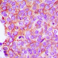 Polyclonal Rabbit anti-Human Alpha 1+2 Catenin Antibody (C-Terminus, IHC, WB)