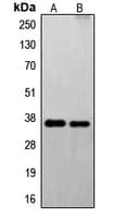 FAIM2 / LIFEGUARD Antibody (N-Terminus)