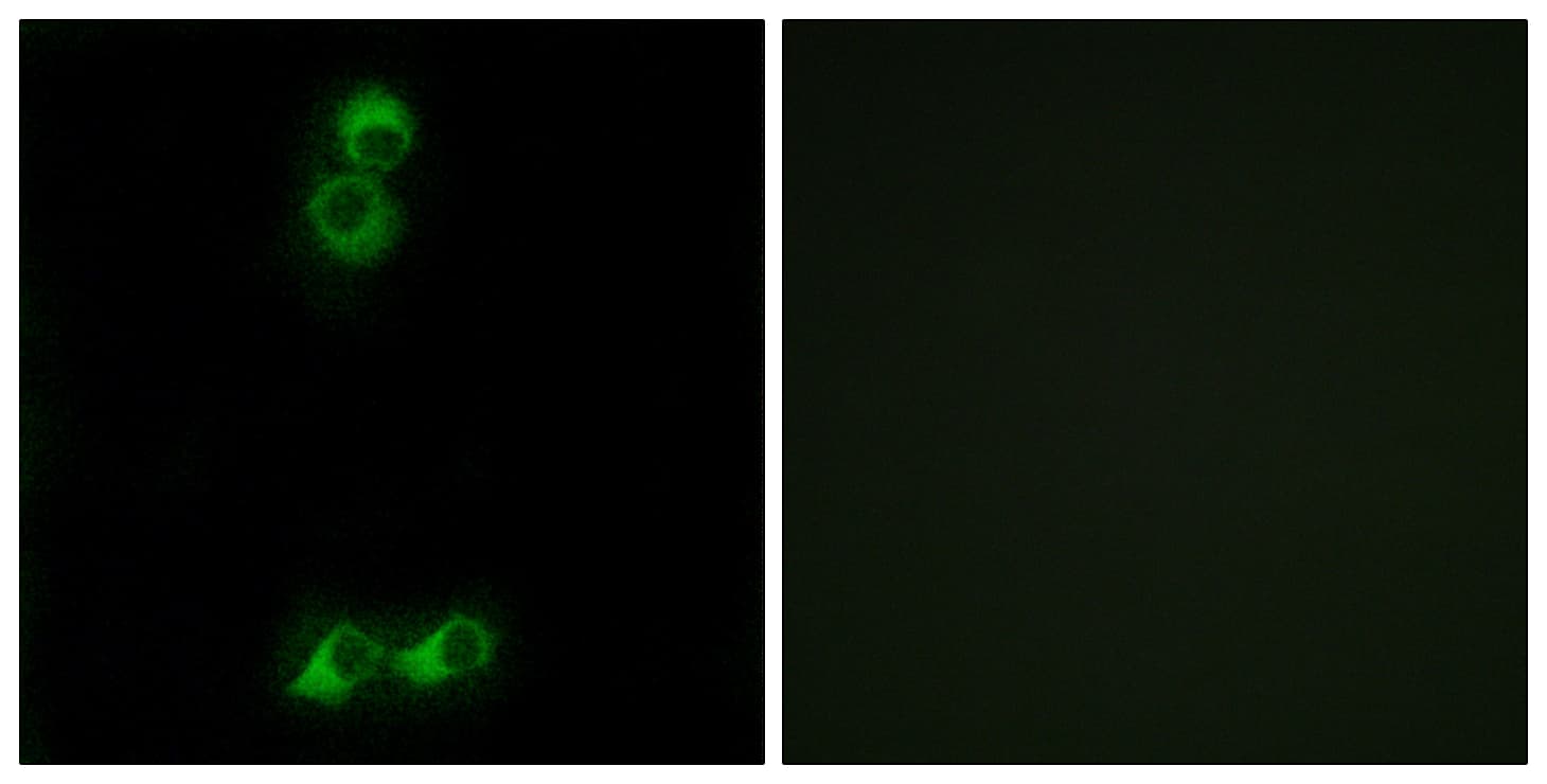 OR10J5 Antibody (aa220-269)