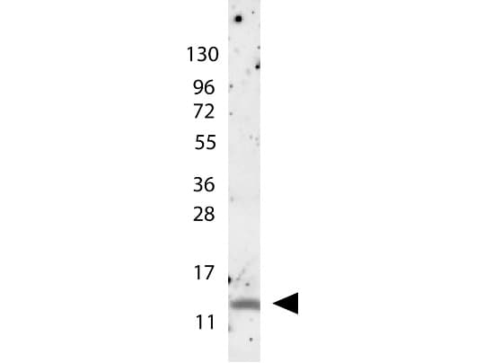 Polyclonal Rabbit anti-Human CCL4 / MIP-1 Beta Antibody (WB)