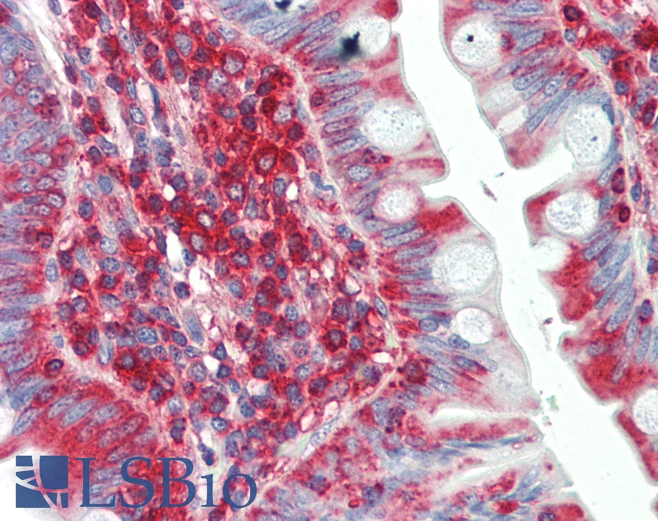 Polyclonal Rabbit anti-Human SCN1B Antibody (aa110-159, IHC, WB)