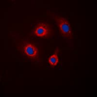 PPP1R1B / DARPP-32 Antibody (phospho-Thr34)