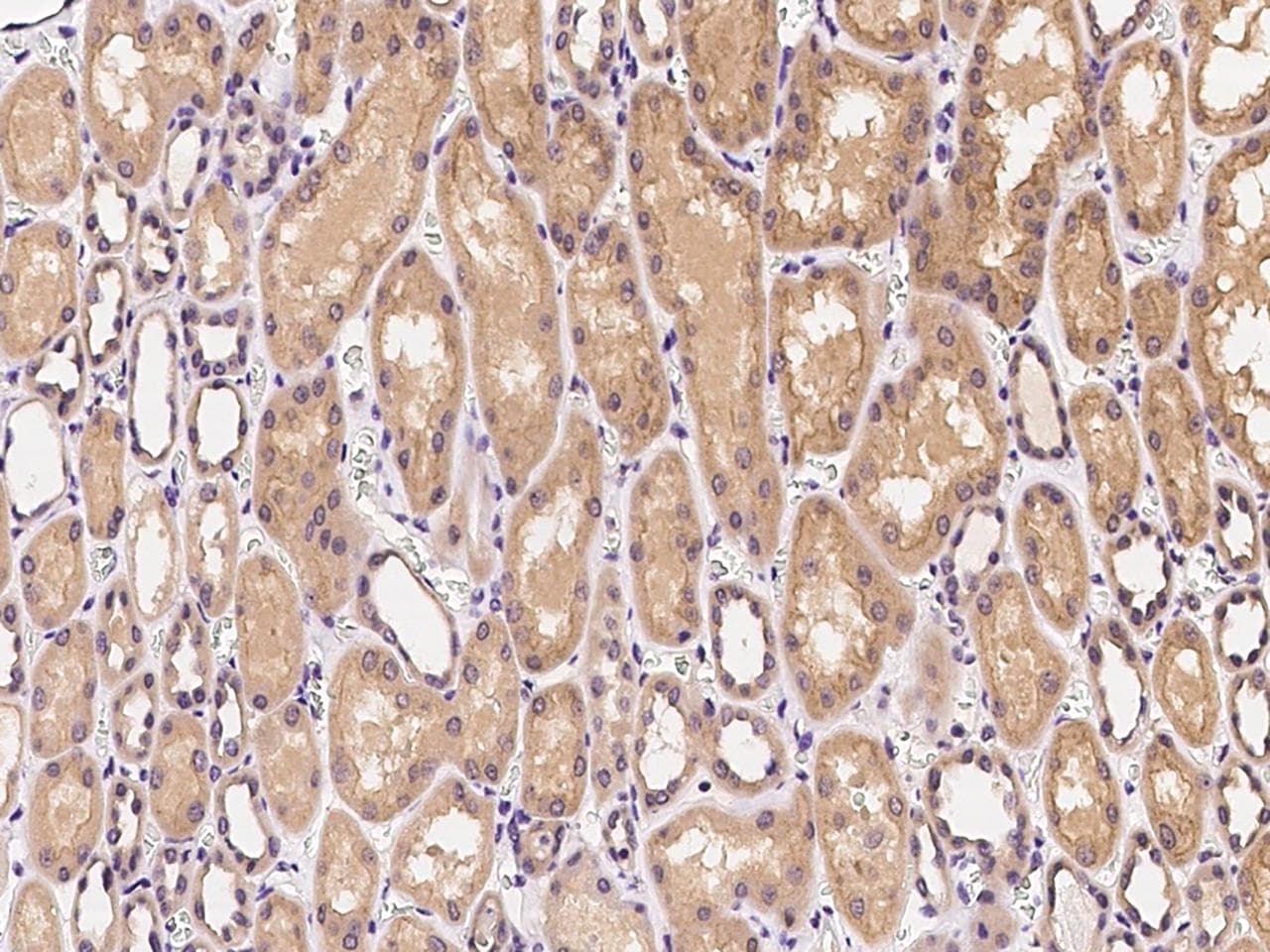 Polyclonal Rabbit anti-Human CLTC / Clathrin Heavy Chain Antibody (IHC, WB)