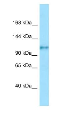 Polyclonal Rabbit anti-Human FCRL5 / CD307 Antibody (aa866-915, IHC, WB)