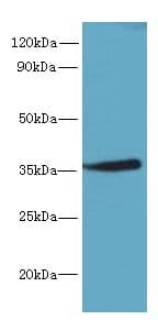 MPPED2 Antibody
