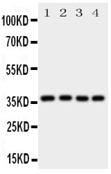 BMI1 / PCGF4 Antibody (aa136-152)