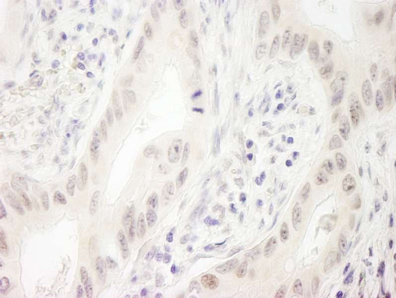 DDX33 / DHX33 Antibody (aa1-50)