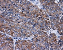 Monoclonal Mouse anti-Human RIP1 / RALBP1 Antibody (clone OTI2A6, IHC, IF, WB)