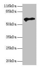 Polyclonal Rabbit anti-Human TPTE Antibody (aa175-380, WB)