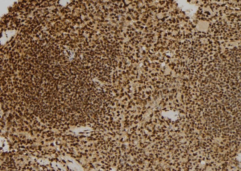 Polyclonal Rabbit anti-Human HSPA9 / Mortalin / GRP75 Antibody (IHC, WB)