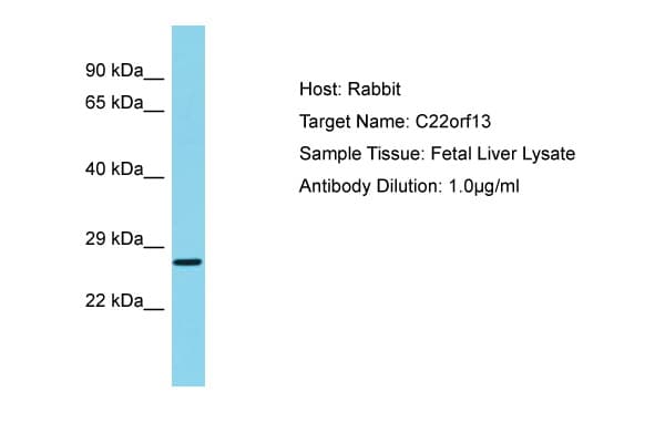 GUCD1 Antibody (C-Terminus)