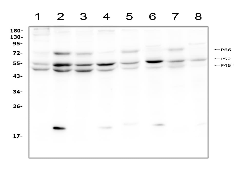 Polyclonal Rabbit anti-Human p66 / SHC Antibody (aa424-440, IHC, WB)