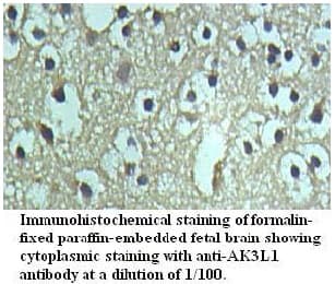 Polyclonal Rabbit anti-Human AK4 / Adenylate Kinase 4 Antibody (aa38-222, IHC)