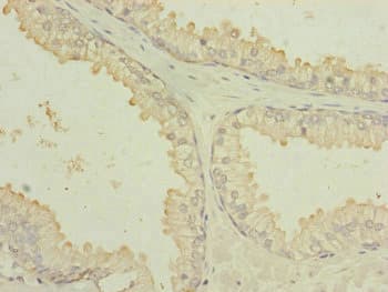 IF3mt / MTIF3 Antibody