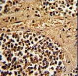 ESRRA / ERR Alpha Antibody (aa131-159)