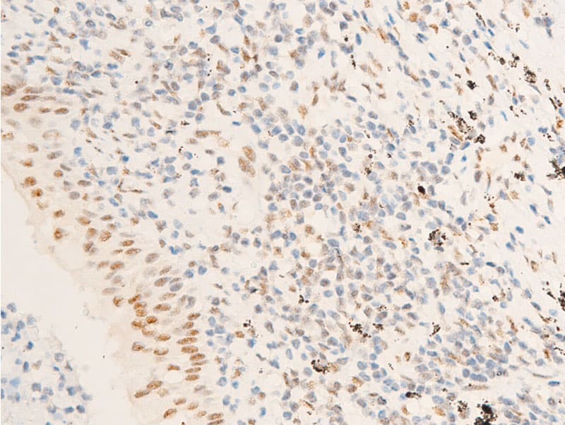 Polyclonal Rabbit anti-Human TK1 / TK / Thymidine Kinase Antibody (phospho-Ser13, IHC, IF, WB)