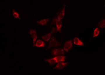 TMBIM4 / GAAP Antibody