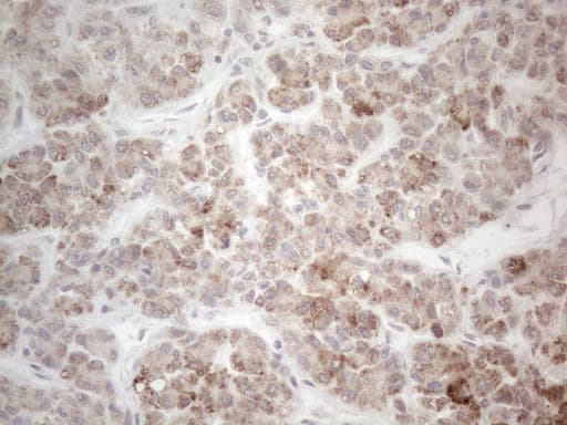 PD-L2 / PDCD1LG2 / CD273 Antibody (clone OTI12C7)