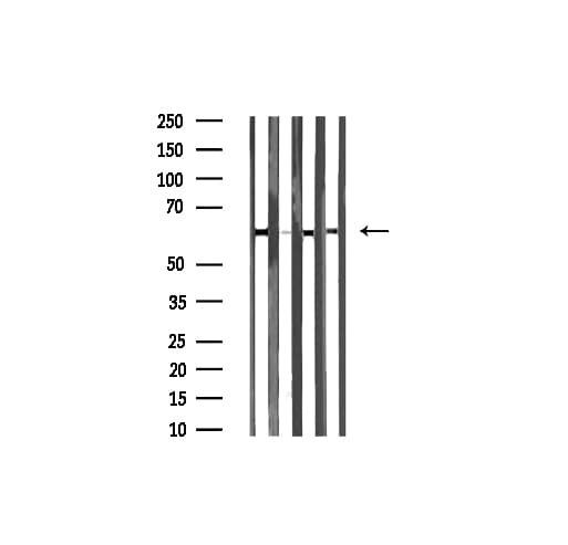 DUS2 / DUS2L Antibody