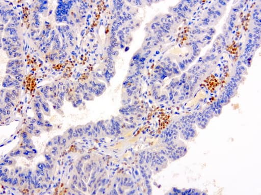 SERPINB4 / SCCA1+2 Antibody (clone UMAB16)