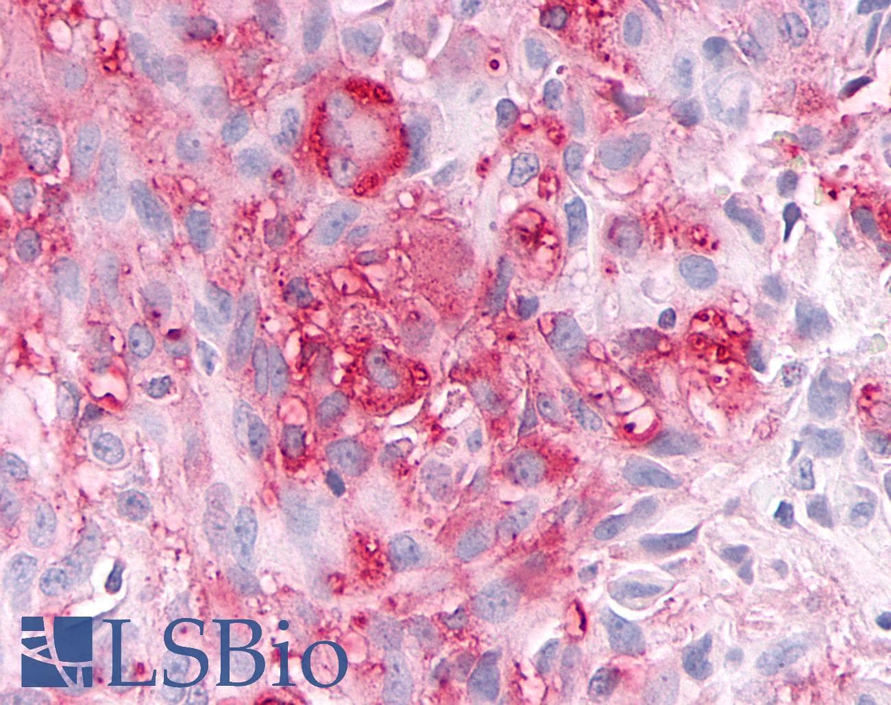 PathPlus™ Polyclonal Rabbit anti-Human ADAMTS4 Antibody (Disintegrin-like Domain, IHC)