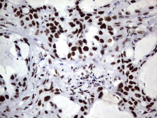 DDX56 Antibody (aa323-547, clone UMAB153)