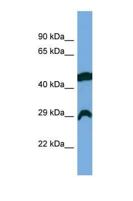 Polyclonal Rabbit anti-Human RCAN2 / RCN2 Antibody (aa89-138, WB)