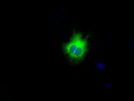 Monoclonal Mouse anti-Human LIPG / Endothelial Lipase Antibody (clone OTI6B11, IHC, IF, WB)